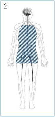 Autonomic Neuropathy Autonomic Neuropathy